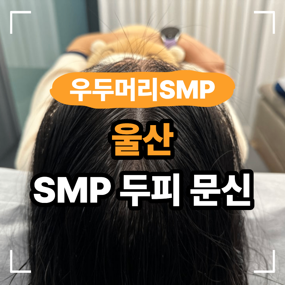 울산 SMP 두피 문신 실패 피하는 선택 기준