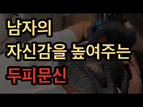 [두피문신] 남자의 자신감을 높여주는 두피문신 (울산 부산 두피문신 SMP 원형탈모 커버 후기)
