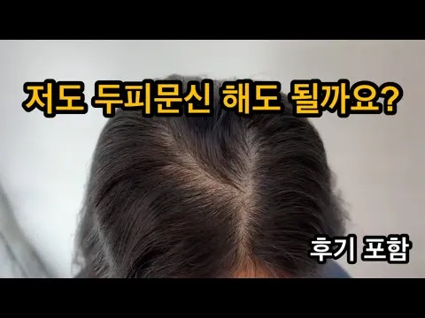 [울산 두피문신] 두피문신 실제 후기 (SMP 우두머리 내돈내산 후기 전후 여성탈모 창업 부업)
